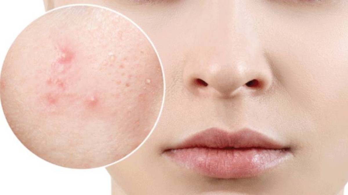 serum-rau-ma-purito-diu-da-lanh-tinh